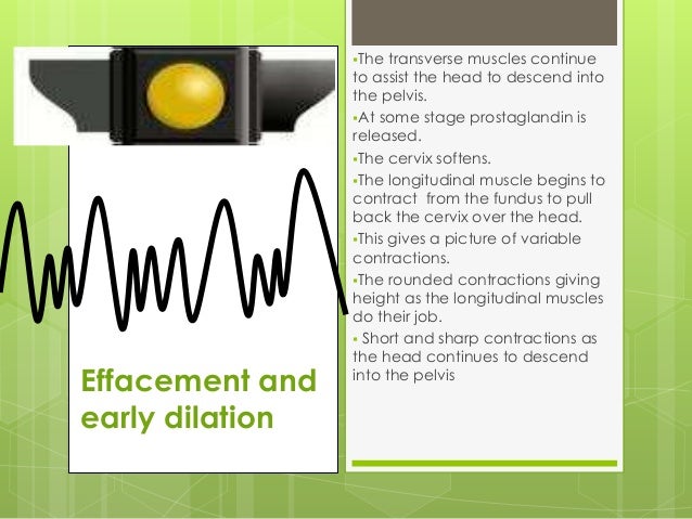 5 Contraction Patterns of Labour
