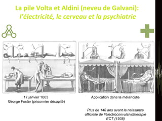 La pile Volta et Aldini (neveu de Galvani):  l’électricité, le cerveau et la psychiatrie 17 janvier 1803  George Foster (prisonnier décapité) Application dans la mélancolie Plus de 140 ans avant la naissance officielle de l’électroconvulsivotherapie ECT (1938) 