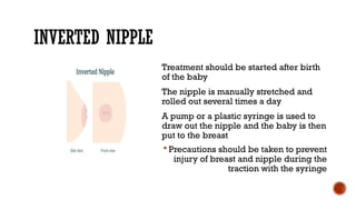 INVERTED NIPPLE
Treatment should be started after birth
of the baby
The nipple is manually stretched and
rolled out several times a day
A pump or a plastic syringe is used to
draw out the nipple and the baby is then
put to the breast
 Precautions should be taken to prevent
injury of breast and nipple during the
traction with the syringe
 