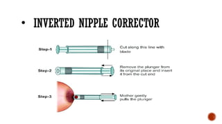 • INVERTED NIPPLE CORRECTOR
 