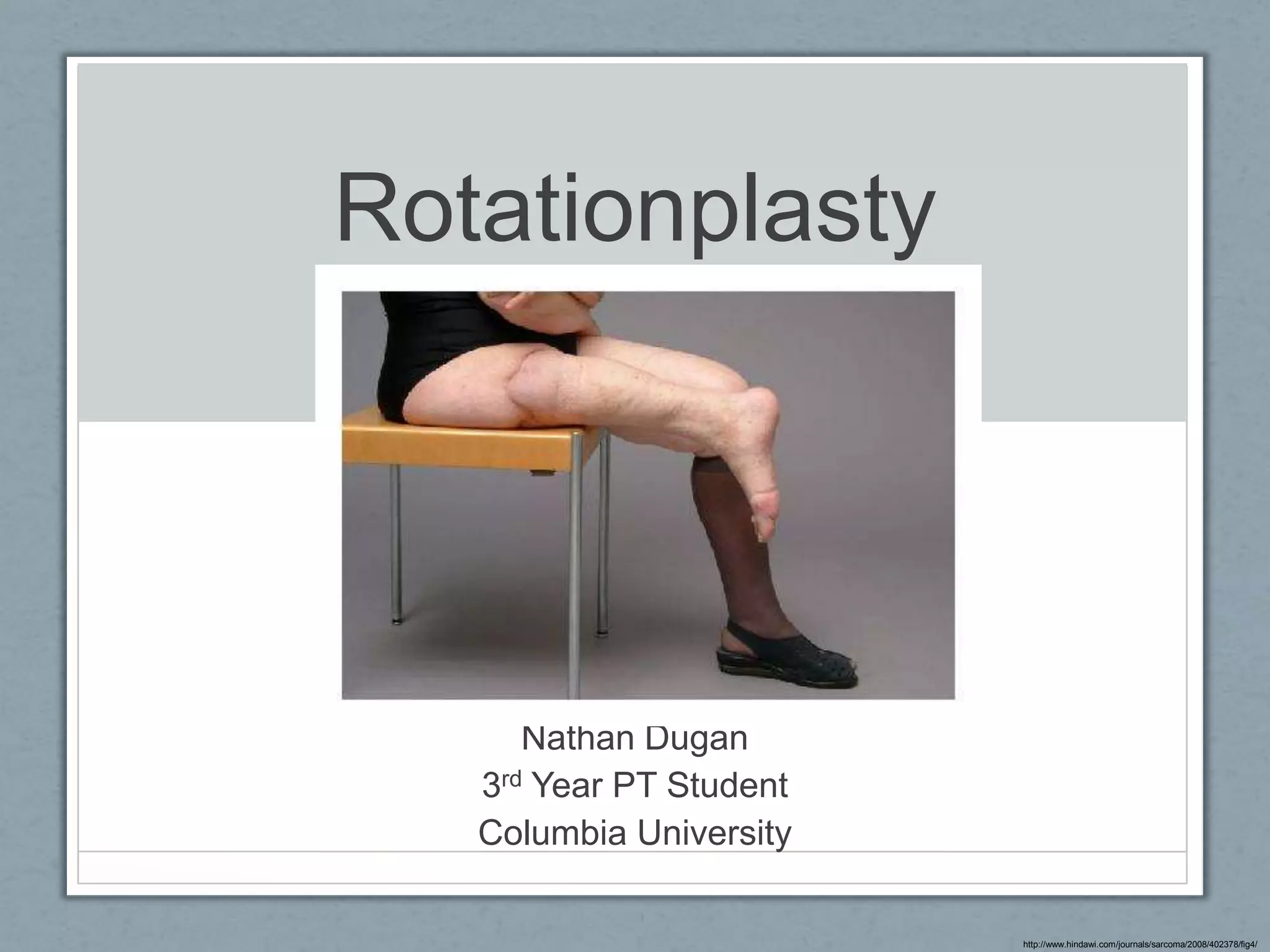 Rotationplasty PPT