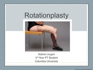 Rotationplasty
Nathan Dugan
3rd Year PT Student
Columbia University
http://www.hindawi.com/journals/sarcoma/2008/402378/fig4/
 