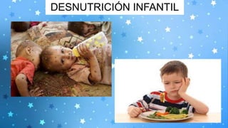 DESNUTRICIÓN INFANTIL
 