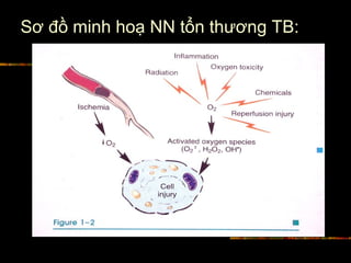 Sơ đồ minh hoạ NN tổn thương TB:
 
