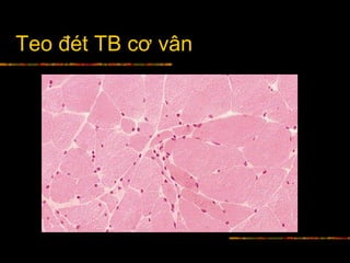 Teo đét TB cơ vân
 