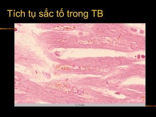 Tích tụ sắc tố trong TB
 