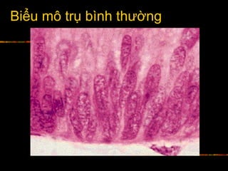 Biểu mô trụ bình thường
 