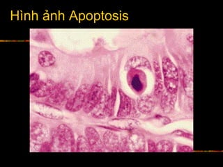 Hình ảnh Apoptosis
 
