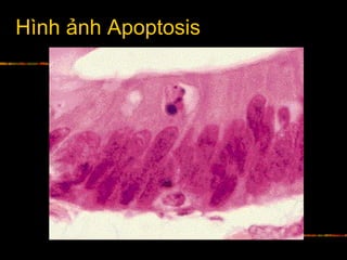 Hình ảnh Apoptosis
 