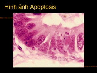 Hình ảnh Apoptosis
 