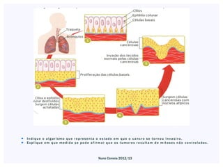    Indique o algarismo que representa o estado em que o cancro se tornou invasivo.
   Explique em que medida se pode afirmar que os tumores resultam de mitoses não controladas.



                                       Nuno Correia 2012/13
 