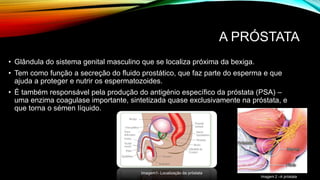 A PRÓSTATA 
• Glândula do sistema genital masculino que se localiza próxima da bexiga. 
• Tem como função a secreção do fluido prostático, que faz parte do esperma e que 
ajuda a proteger e nutrir os espermatozoides. 
• É também responsável pela produção do antigénio específico da próstata (PSA) – 
uma enzima coagulase importante, sintetizada quase exclusivamente na próstata, e 
que torna o sémen líquido. 
Imagem 2 –A próstata 
Imagem1- Localização da próstata 
 