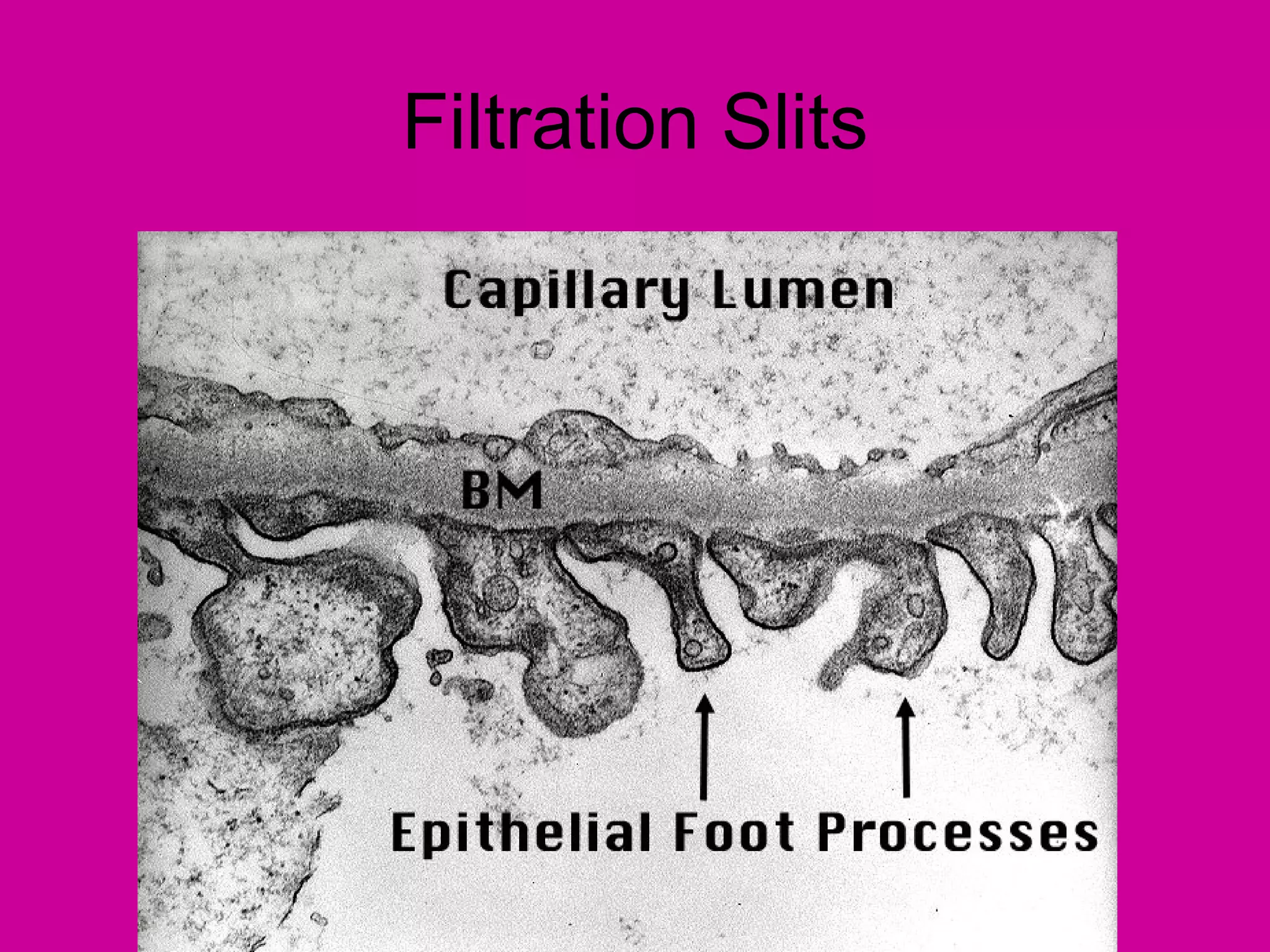 Filtration Slits
 