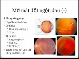 Vm Rach BG CÁC NGUYÊN NHÂN MỜ MẮT ĐHYD.pptx
