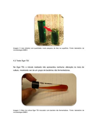 Imagem 3: tubo (direita) com quantidade muito pequena de óleo na superfície. Fonte: laboratório de
microbiologia-UNIBH.
4.3 Teste Ágar TSI
No Ágar TSI, o inóculo realizado não apresentou nenhuma alteração no meio de
cultura, mostrando ser de um grupo de bactérias não fermentadoras.
Imagem 3: Meio de cultura Ágar TSI inoculado com bactéria não fermentadora. Fonte: laboratório de
microbiologia-UNIBH.
 