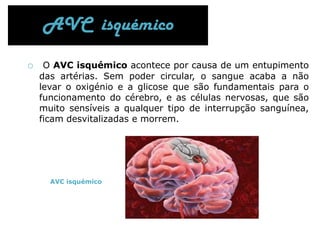 As causas mais comuns são os trombos (coágulo de sangue que se forma numa artéria ou numa veia e que provoca trombose), a embolia (obliteração de uma artéria secundária) e a hemorragia.Apresenta-se como a 2ª causa de morte no mundo. 