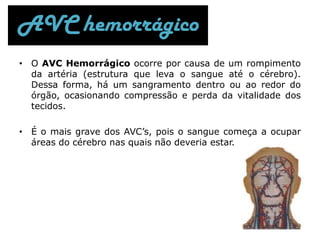 Tratamento preventivo;