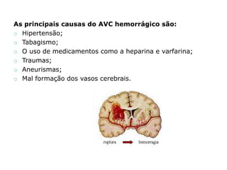 Tratamento de reabilitação pós-acidente vascular cerebral. 
