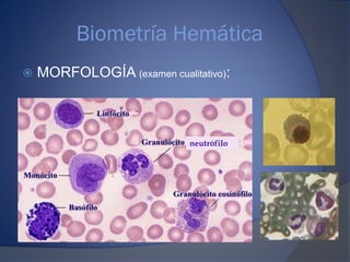 Biometría Hemática
 MORFOLOGÍA (examen cualitativo):
neutrófilo
 