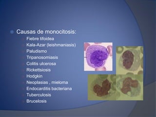  Causas de monocitosis:
○ Fiebre tifoidea
○ Kala-Azar (leishmaniasis)
○ Paludismo
○ Tripanosomiasis
○ Colitis ulcerosa
○ Rickettsiosis
○ Hodgkin
○ Neoplasias , mieloma
○ Endocarditis bacteriana
○ Tuberculosis
○ Brucelosis
 