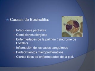  Causas de Eosinofilia:
○ Infecciones parásitas
○ Condiciones alérgicas
○ Enfermedades de la pulmón ( síndrome de
Loeffler)
○ Inflamación de los vasos sanguíneos
○ Padecimientos mieloproliferativos
○ Ciertos tipos de enfermedades de la piel.
 
