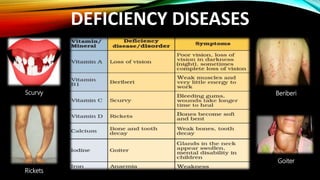 DEFICIENCY DISEASES
Scurvy
Rickets
Beriberi
Goiter
 