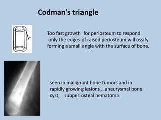 Codman's triangle

  Too fast growth for periosteum to respond
   only the edges of raised periosteum will ossify
  forming a small angle with the surface of bone.




   seen in malignant bone tumors and in
   rapidly growing lesions .. aneurysmal bone
   cyst, subperiosteal hematoma.
 