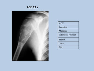 AGE 13 Y




           AGE
           Location
           Margins
           Periosteal reaction

           Matrix
           other
           DX
 