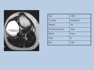 Age                   Adult

Location              metaphysis

Margin                1B

Periosteal reaction   None

Matrix                None

other                 fx

DX                    ABC
 