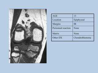 AGE                   13
Location              Epiphyseal
Margins               IB
Periosteal reaction   None

Matrix                None
Other DX              Chondroblastoma
 