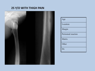25 Y/O WITH THIGH PAIN


                         Age

                         Location

                         Margin

                         Periosteal reaction

                         Matrix

                         Other

                         Dx
 