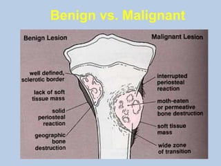 Benign vs. Malignant
 