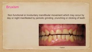 Bruxism
Non functional or involuntary mandibular movement which may occur by
day or night manifested by periodic grinding ,crunching or clicking of teeth
Caption
 