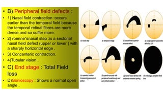 • B) :
• 1) Nasal field contraction :occurs
earlier than the temporal field because
the temporal retinal fibres are more
dense and so suffer more.
• 2) roenne”snasal step :is a sectorial
nasal field defect (upper or lower ) with
a sharply horizontal edge .
• 3) Concenteric contraction.
• 4)Tubular vision .
• C) End stage : Total Field
loss
• D)Gonioscopy : Shows a normal open
angle .
 