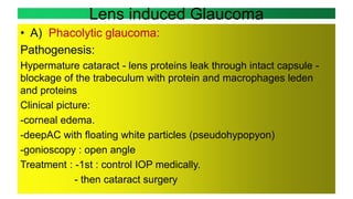 Lens induced Glaucoma
• A) Phacolytic glaucoma:
Pathogenesis:
Hypermature cataract - lens proteins leak through intact capsule -
blockage of the trabeculum with protein and macrophages leden
and proteins
Clinical picture:
-corneal edema.
-deepAC with floating white particles (pseudohypopyon)
-gonioscopy : open angle
Treatment : -1st : control IOP medically.
- then cataract surgery
 
