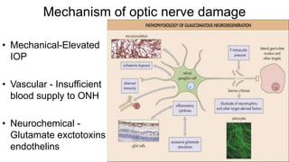 Mechanism of optic nerve damage
• Mechanical-Elevated
IOP
• Vascular - Insufficient
blood supply to ONH
• Neurochemical -
Glutamate exctotoxins ,
endothelins
 