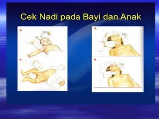 Bhd Rjp Panduan Lengkap Bantuan Hidup Dasar (BHD) dan Teknik RJP | PPT