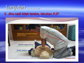 Bhd Rjp Panduan Lengkap Bantuan Hidup Dasar (BHD) dan Teknik RJP | PPT
