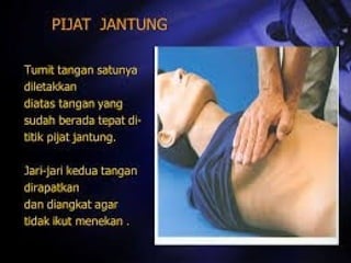 Ppt Rjp Panduan Lengkap Bantuan Hidup Dasar (BHD) dan Teknik RJP | PPT