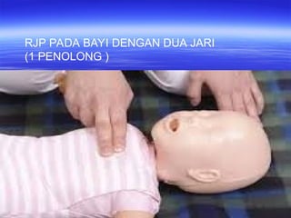 Bhd Rjp Panduan Lengkap Bantuan Hidup Dasar (BHD) dan Teknik RJP | PPT