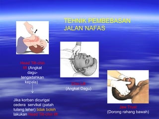 Bhd Rjp Panduan Lengkap Bantuan Hidup Dasar (BHD) dan Teknik RJP | PPT