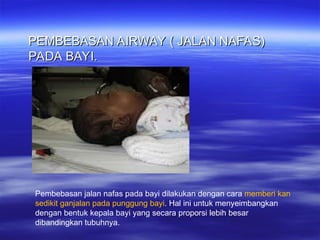 Bhd Rjp Panduan Lengkap Bantuan Hidup Dasar (BHD) dan Teknik RJP | PPT