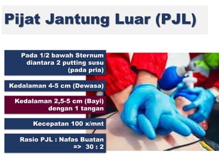 Pijat Jantung Luar (PJL)
Pada 1/2 bawah Sternum
diantara 2 putting susu
(pada pria)
Kedalaman 4-5 cm (Dewasa)
Kedalaman 2,5-5 cm (Bayi)
dengan 1 tangan
Kecepatan 100 x/mnt
Rasio PJL : Nafas Buatan
=> 30 : 2
 
