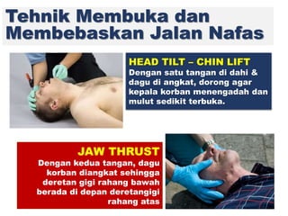 Tehnik Membuka dan
Membebaskan Jalan Nafas
JAW THRUST
Dengan kedua tangan, dagu
korban diangkat sehingga
deretan gigi rahang bawah
berada di depan deretangigi
rahang atas
HEAD TILT – CHIN LIFT
Dengan satu tangan di dahi &
dagu di angkat, dorong agar
kepala korban menengadah dan
mulut sedikit terbuka.
 