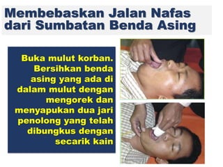 Membebaskan Jalan Nafas
dari Sumbatan Benda Asing
Buka mulut korban.
Bersihkan benda
asing yang ada di
dalam mulut dengan
mengorek dan
menyapukan dua jari
penolong yang telah
dibungkus dengan
secarik kain
 