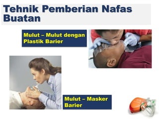 Tehnik Pemberian Nafas
Buatan
Mulut – Mulut dengan
Plastik Barier
Mulut – Masker
Barier
 