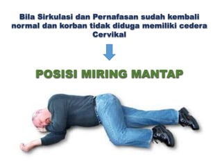 Bila Sirkulasi dan Pernafasan sudah kembali
normal dan korban tidak diduga memiliki cedera
Cervikal
POSISI MIRING MANTAP
 