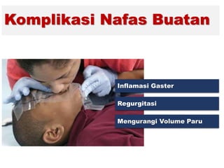 Komplikasi Nafas Buatan
Inflamasi Gaster
Regurgitasi
Mengurangi Volume Paru
 