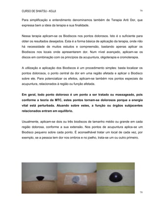 CURSO DE SHIATSU - KOJJI 79
79
Para simplificação e entendimento denominamos também de Terapia Anti Dor, que
expressa bem a ideia da terapia e sua finalidade.
Nessa terapia aplicam-se os Biodiscos nos pontos dolorosos. Isto é o suficiente para
obter os resultados desejados. Esta é a forma básica de aplicação da terapia, onde não
há necessidade de muitos estudos e compreensão, bastando apenas aplicar os
Biodiscos nos locais onde apresentarem dor. Num nível avançado, aplicam-se os
discos em combinação com os princípios da acupuntura, oligoterapia e cromoterapia.
A utilização e aplicação dos Biodiscos é um procedimento simples: basta localizar os
pontos dolorosos, o ponto central da dor em uma região afetada e aplicar o Biodisco
sobre ele. Para potencializar os efeitos, aplicam-se também nos pontos especiais da
acupuntura, relacionados à região ou função afetada.
Em geral, todo ponto doloroso é um ponto a ser tratado ou massageado, pois
conforme a teoria da MTC, estes pontos tornam-se dolorosos porque a energia
vital está perturbada. Atuando sobre estes, a função ou órgãos subjacentes
relacionados entram em equilíbrio.
Usualmente, aplicam-se dois ou três biodiscos de tamanho médio ou grande em cada
região dolorosa, conforme a sua extensão. Nos pontos de acupuntura aplica-se um
Biodisco pequeno sobre cada ponto. É aconselhável tratar um local de cada vez, por
exemplo, se a pessoa tem dor nos ombros e no joelho, trata-se um ou outro primeiro.
 