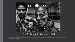 Bhopal Gas Tragedy - Documentary by Raghu Rai | PPTX